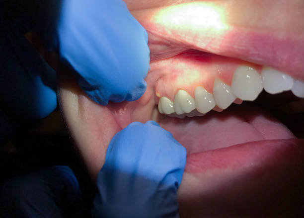 Best Emergency Broken Tooth Repair in Fowlkes, TN